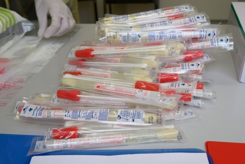 Sergipe aguarda autorização para distribuir testes rápidos para detecção do novo coronavírus.