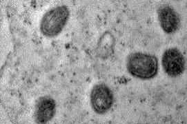 Sergipe registra mais dois casos de Monkeypox