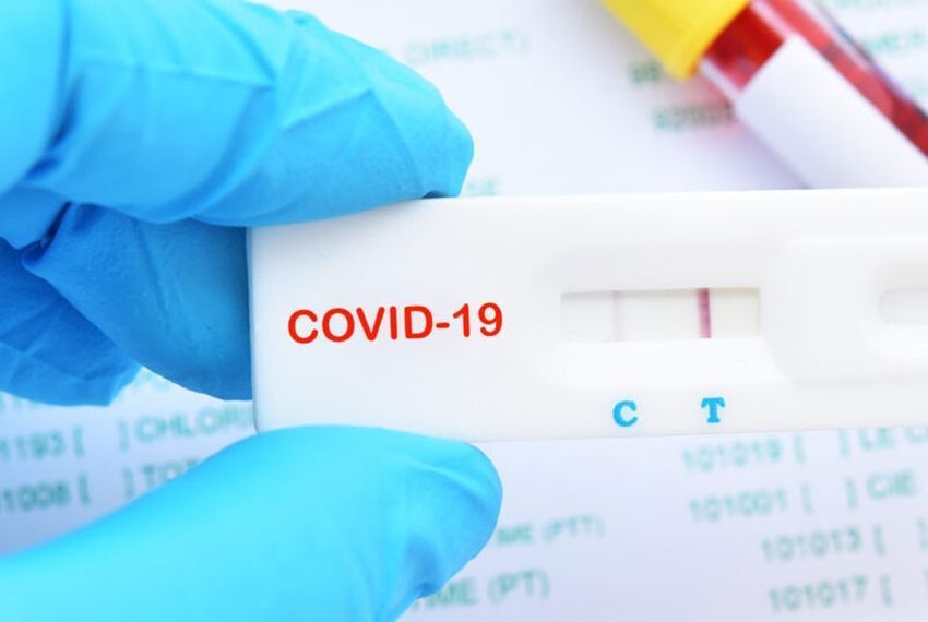 Sergipe registra 10 casos novos de COVID-19