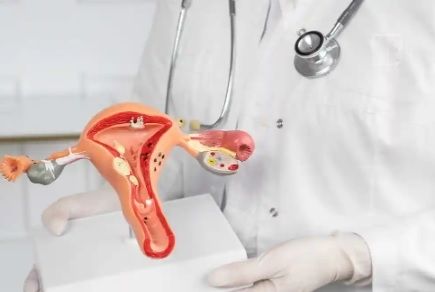MPF quer retomar cirurgias de Endometriose no HU