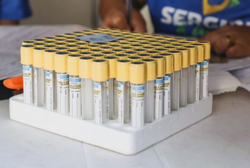 Sergipe já realizou mais de 2.500 testes para detecção de câncer