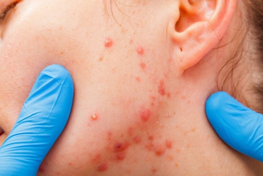 Dermatologista alerta para cuidados com a pele